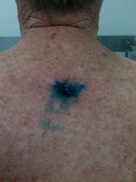 blue dye